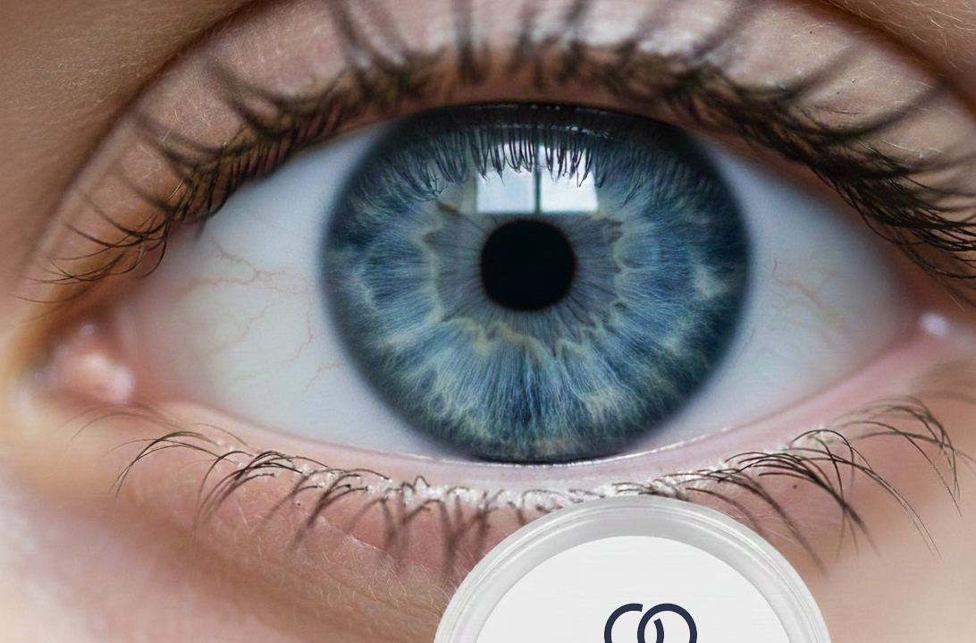 lentilles de contact - Espace Vision