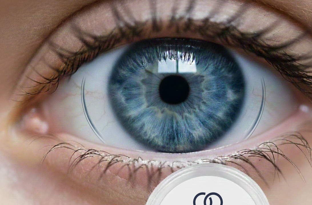 lentilles de contact - Espace Vision